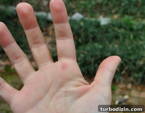 How Tree Limbing Restores Your View of the House 12 Blister from clipping